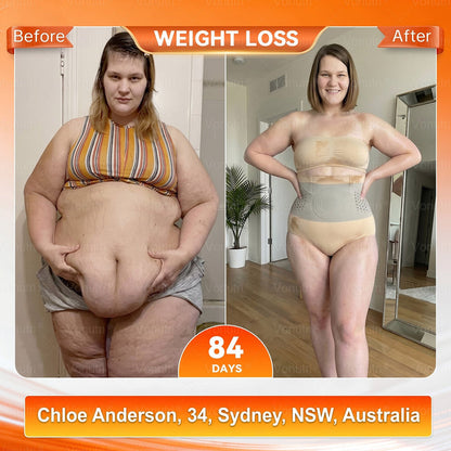 4-In-1 Sculpting & Fat-Burn Shorts
