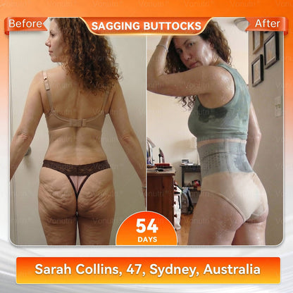 4-In-1 Sculpting & Fat-Burn Shorts