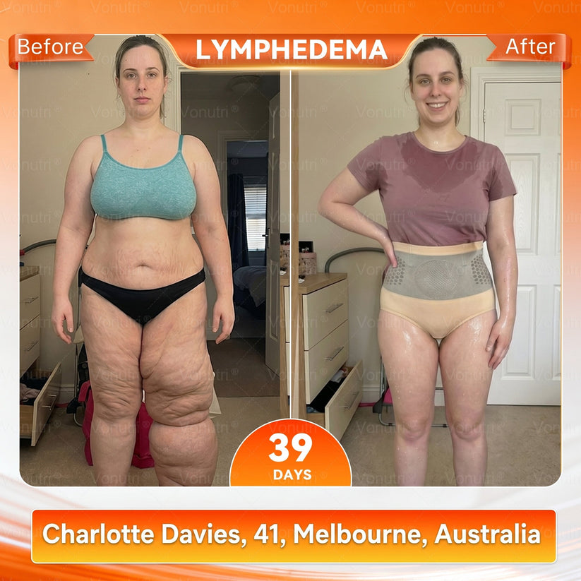 4-In-1 Sculpting & Fat-Burn Shorts