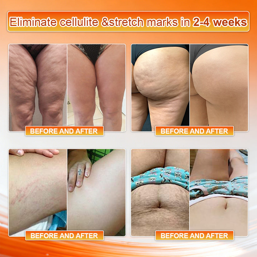 4-In-1 Sculpting & Fat-Burn Shorts