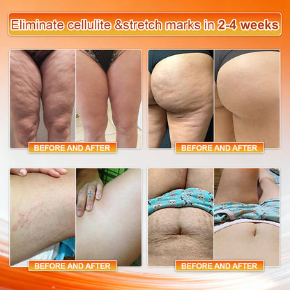 4-In-1 Sculpting & Fat-Burn Shorts